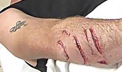 20071217-Shark-Attack-Wright-by-Channel-10